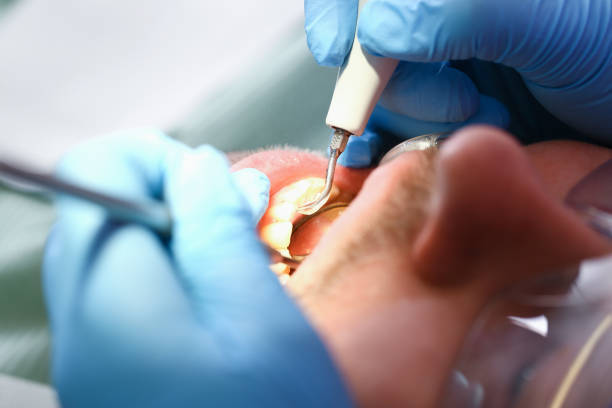 Best Broken or Cracked Tooth Emergency Dentist in Graniteville, SC